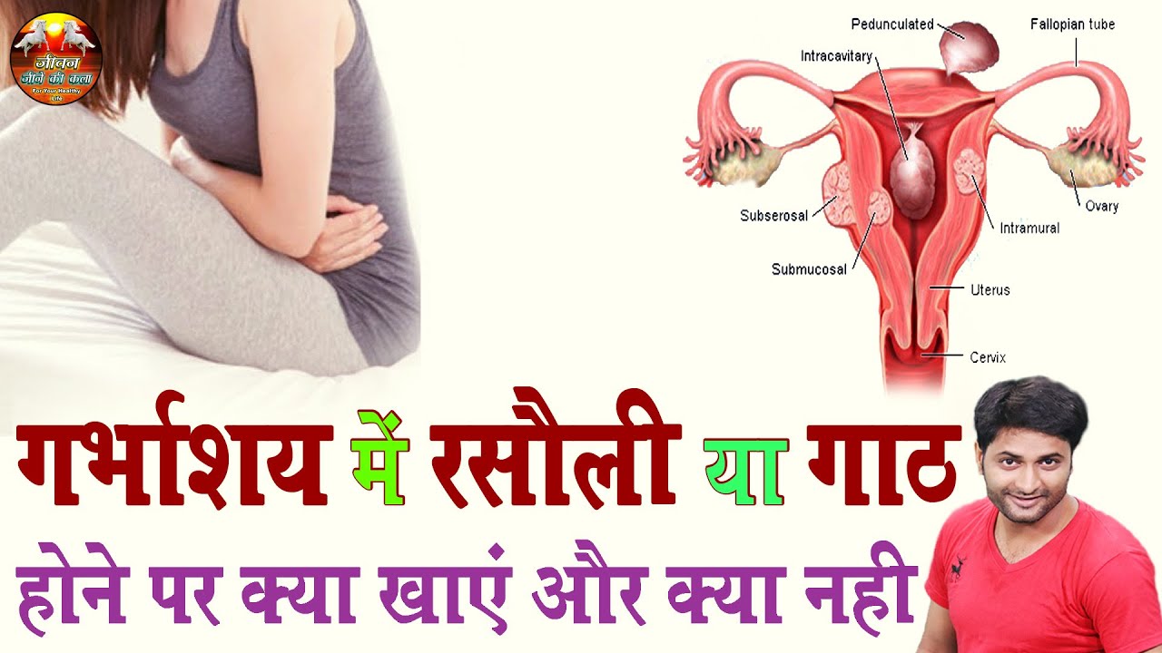 What is the meaning of Rasoli || गर्भाशय, बच्चेदानी में गांठ या रसौली ...