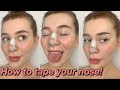 HOW TO TAPE YOUR NOSE AFTER A NOSE JOB! | Rhinoplasty/Septoplasty