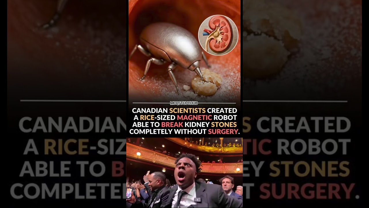 😱😱 Magnetic robot able to break kidney stones 