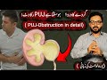 Do you have these symptoms ❓️| PUJ-Obstruction |Urologist|Dr Ghazanfar Rafeq #pujo  #surgeryoptions 