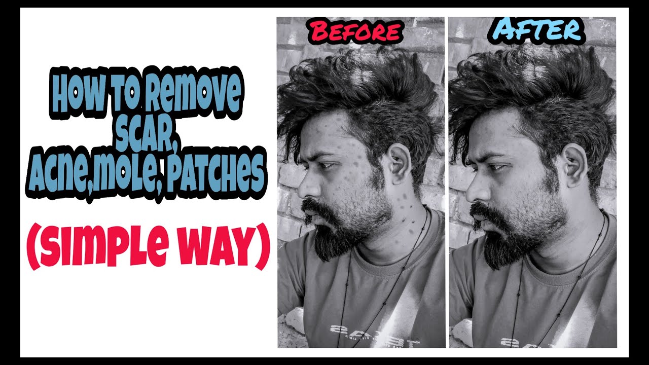 How to remove scar,acne ,mole in simple way| PicsArt| sevamsan