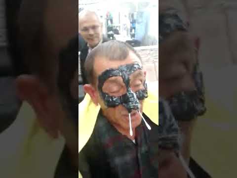 My uncle's waxing treatment