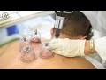 Hijama cupping therapy at 7 dimensions medical centre