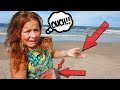 WORST JELLY FISH STING EVER!! ON FATHER'S DAY!