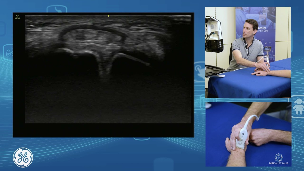 Sonographic assessment of the dorsal wrist for POCUS clinicians