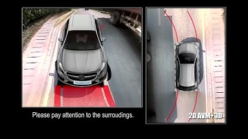 AVM-360 Around View Monitoring System | CandidTech