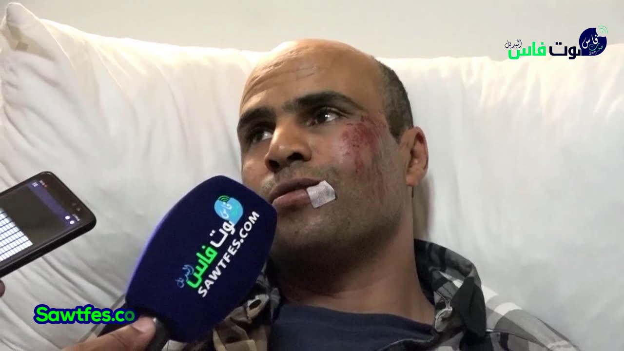 روتبي احمد موظف بالسجن المحلي راس الماء تعرض الى الضرب يوم العيد من طرف المجرم خطير ساط