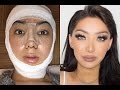 My Facial Plastic Surgery Story! | Dragun