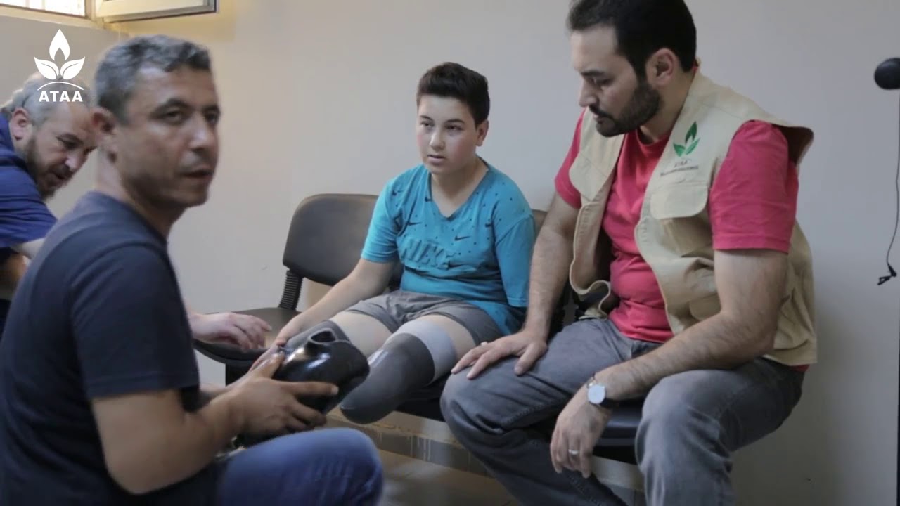 تركيب طرف صناعي للطفل حمد الحسين