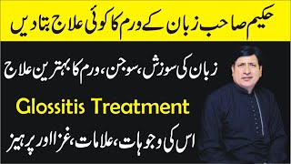 Zuban ke waram ka ilaj |Glossitis Treatment | Zuban ki sozisha,sujan ka ilaj| Hakeemabubakarsiddique