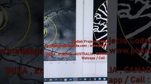 Retinal Vessel Tortuosity in FUNDUS Images