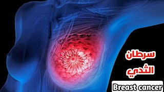 شاهد كيف يتم ازاله سرطان الثدي للنساء_Watch how breast cancer is removed for women