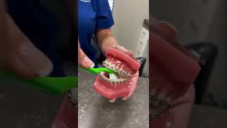 Tips For Brushing Your Teeth With Braces