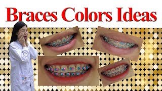 Braces Colours Ideas!