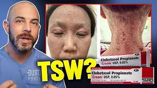 Is Topical Steroid Withdrawal Real? Dermatologist Answers TSW