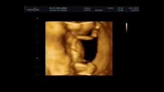 видео 14 неделя беременности
