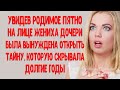 Увидев родимое пятно на лице жениха дочери, была вынуждена рассказать то, о чем молчала много лет