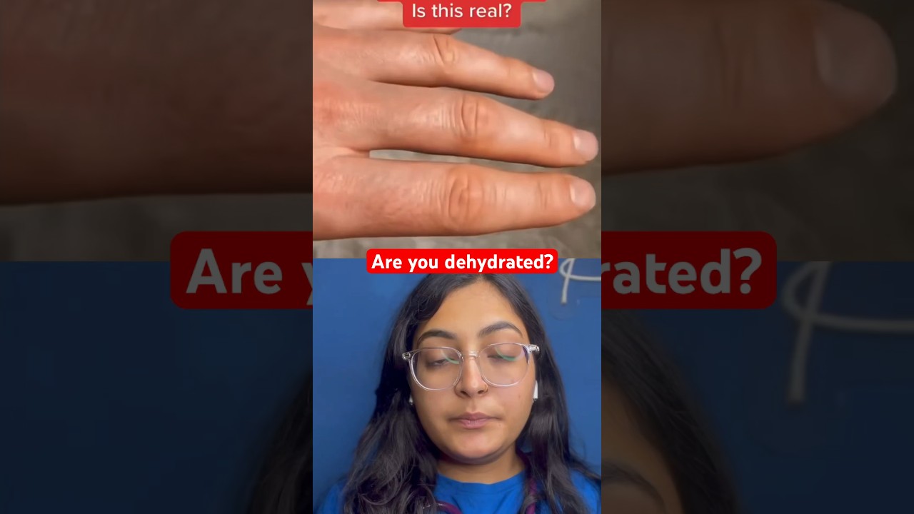 DEHYDRATION CHECK ⁉️ | are you hydrated enough? check yourself now!