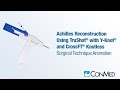 Achilles Reconstruction Using TruShot® and CrossFT® Knotless - CONMED Animation