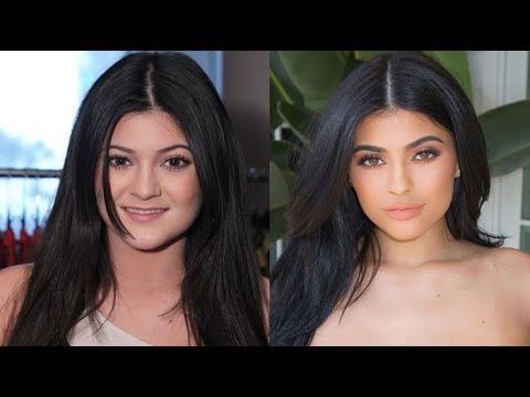 Video: Kylie Jenner sebelum dan sesudah operasi plastik