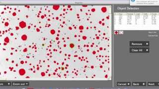 Particle Dispersion Analysis for Ductile Iron