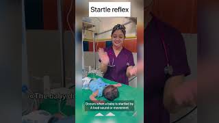 Startle reflex in newborn | moro’s reflex | baby doctor #newborn #babyvideos #shorts #cutebaby screenshot 3