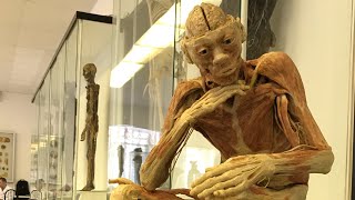 Анатомический музей (Слабонервным не смотреть!) Anatomical museum