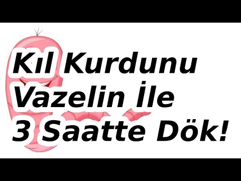 Kıl Kurdu Vazelin ile 3 Saatte Nasıl Dökülür? Bağırsak Kurdu Belirtileri Nelerdir? En İyi İlaç?