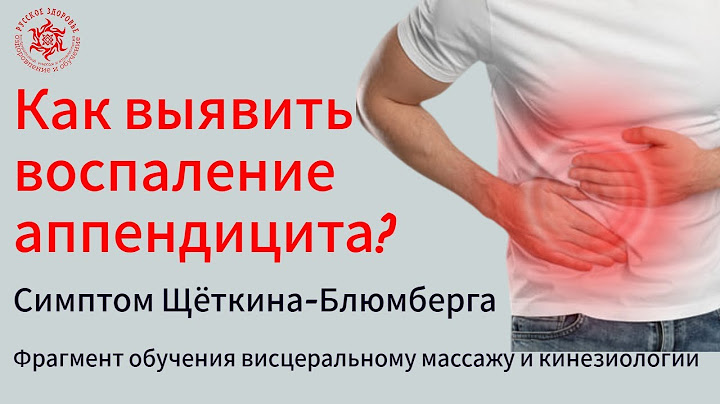 Как выявить воспаление аппендицита? Симптом Щёткина-Блюмберга. Фрагмент обучения