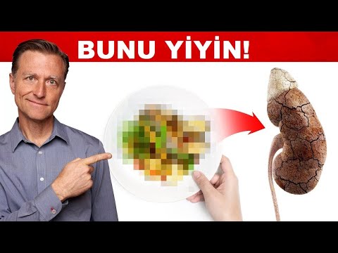 Böbrek Zehirlenmesi Tedavisi İçin En iyi Yiyecek | Dr.Berg Türkçe