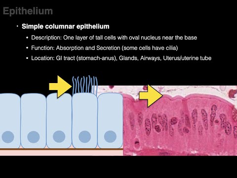 Video: Puas squamous epithelial cells phem?