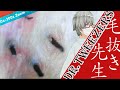 281 [200x Zoom] Many black pillars Dr. tweezers 毛抜き先生の角栓や毛根