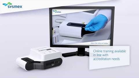 UC-1000 Semi-automated Urine Chemistry Analyser