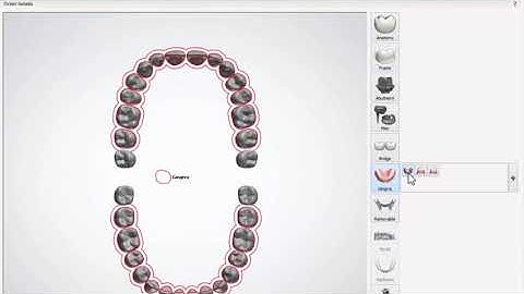 3Shape Dental System   Full Denture   Order Form Creation