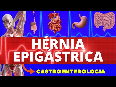 Vídeo: O que é epigástrica abdominal?