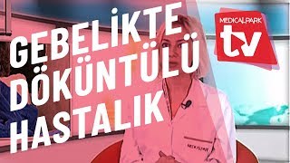Gebelikte Döküntülü Hastalık Riski Medical Park Tv