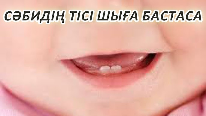 Оның беріліс тетігінде отырған кискасының суреті