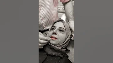 هل تحبون تسون عملية تجميل الانف و ملامحكم يكون اكتر جذابيه فقط راسلوني 