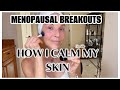 MENOPAUSAL BREAKOUTS | WHAT I DO TO HELP #menopauseisathief