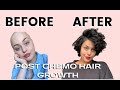 Post chemo HAIR GROWTH journey!