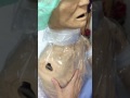 كيف نفحص ونعمل تقييم صحي على الجهاز التنفسي الصدر والرئتين Respiratory Assessment 