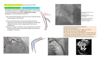 Guide dissection: cases and management