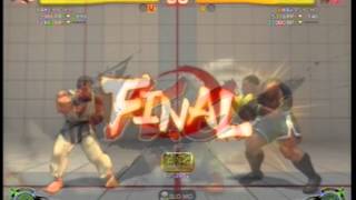 BAKERBOY99 SSF4ae RYU