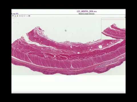 Anatomy | Histology of the Esophagus