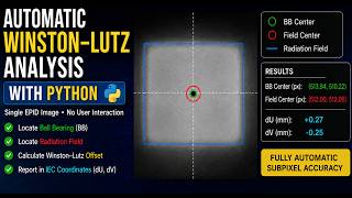 Automatic Winston–Lutz Analysis in Python (Single EPID Image)