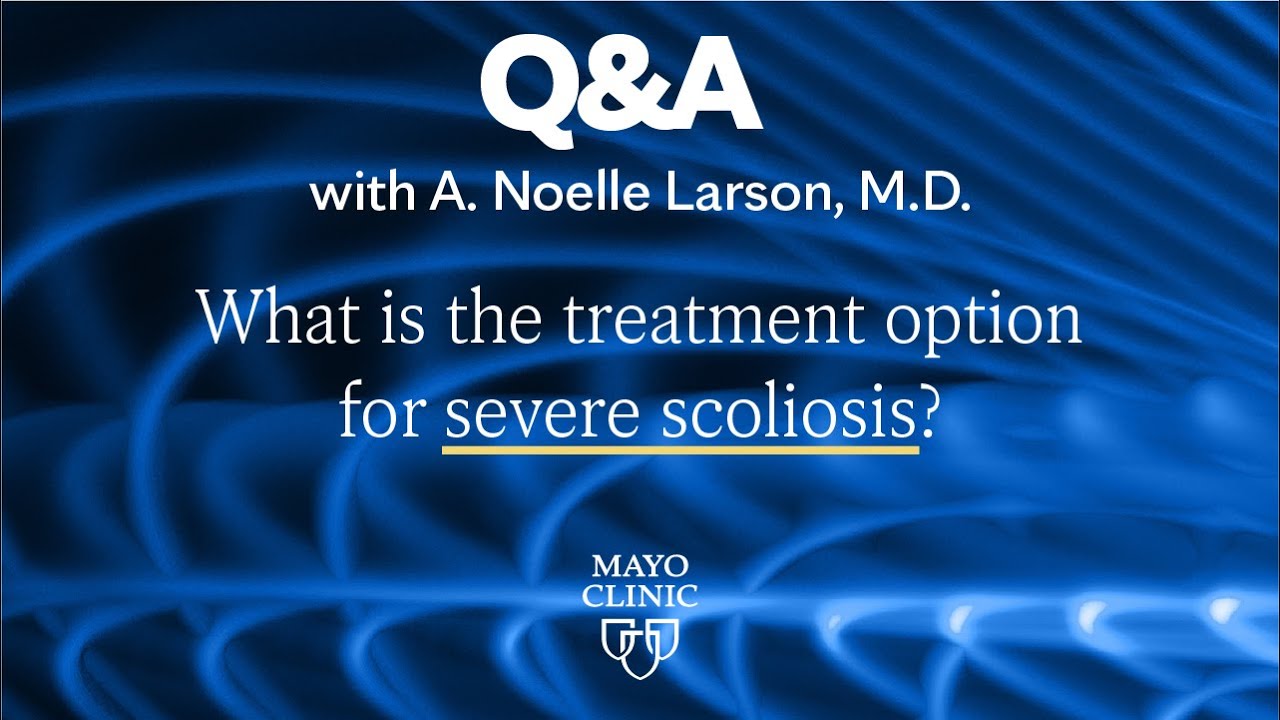 Mayo Clinic Q and A: Nonsurgical treatments may decrease pain from spinal  stenosis - Mayo Clinic News Network