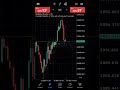 Patient is one of the key instrument needed in forex trading 🔨📊