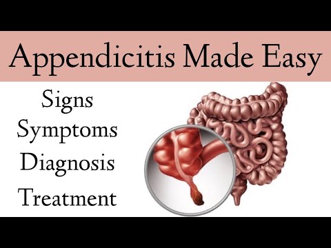 Appendicitis Signs, Symptoms, Examination, Diagnosis, Treatment