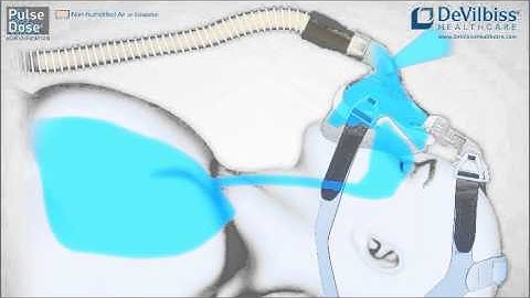 IntelliPap 2 CPAP Machine PulseDose