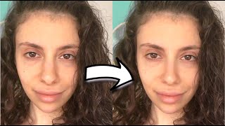 I'M GETTING A NOSE JOB & THIS IS HOW IT MIGHT LOOK!